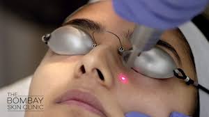 Pigmentation Removal